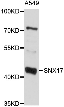 SNX17 Antibody - Western blot analysis of extracts of A-549 cells, using SNX17 antibody at 1:1000 dilution. The secondary antibody used was an HRP Goat Anti-Rabbit IgG (H+L) at 1:10000 dilution. Lysates were loaded 25ug per lane and 3% nonfat dry milk in TBST was used for blocking. An ECL Kit was used for detection and the exposure time was 10s.