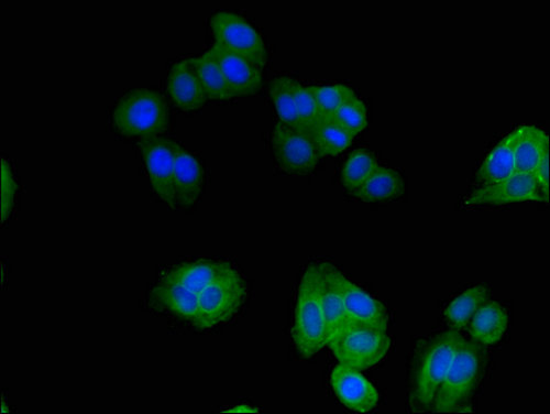 SNX17 Antibody - Immunofluorescent analysis of HepG2 cells using SNX17 Antibody at a dilution of 1:100 and Alexa Fluor 488-congugated AffiniPure Goat Anti-Rabbit IgG(H+L)