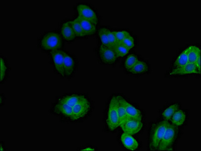SNX17 Antibody - Immunofluorescent analysis of HepG2 cells using SNX17 Antibody at dilution of 1:100 and Alexa Fluor 488-congugated AffiniPure Goat Anti-Rabbit IgG(H+L)