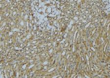 SNX17 Antibody - 1:100 staining mouse kidney tissue by IHC-P. The sample was formaldehyde fixed and a heat mediated antigen retrieval step in citrate buffer was performed. The sample was then blocked and incubated with the antibody for 1.5 hours at 22°C. An HRP conjugated goat anti-rabbit antibody was used as the secondary.