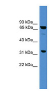 SNX18 Antibody - SNX18 antibody Western blot of A549 cell lysate. This image was taken for the unconjugated form of this product. Other forms have not been tested.
