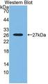 SNX18 Antibody - Western blot of SNX18 antibody.
