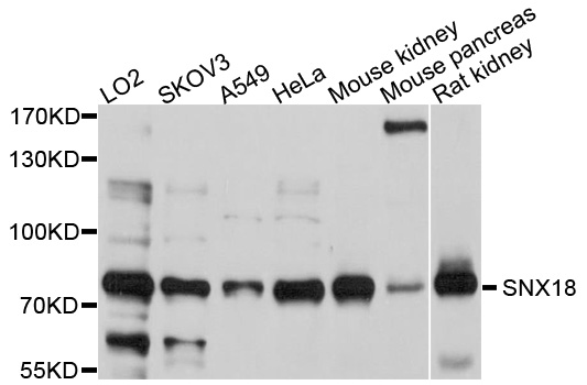 SNX18 Antibody - Western blot analysis of extracts of various cell lines, using SNX18 antibody at 1:1000 dilution. The secondary antibody used was an HRP Goat Anti-Rabbit IgG (H+L) at 1:10000 dilution. Lysates were loaded 25ug per lane and 3% nonfat dry milk in TBST was used for blocking. An ECL Kit was used for detection and the exposure time was 60s.