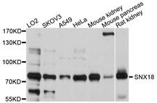 SNX18 Antibody - Western blot analysis of extracts of various cell lines, using SNX18 antibody at 1:1000 dilution. The secondary antibody used was an HRP Goat Anti-Rabbit IgG (H+L) at 1:10000 dilution. Lysates were loaded 25ug per lane and 3% nonfat dry milk in TBST was used for blocking. An ECL Kit was used for detection and the exposure time was 60s.