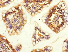 SNX18 Antibody - Immunohistochemistry of paraffin-embedded human small intestine at dilution 1:100