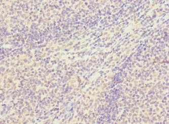 SNX18 Antibody - Immunohistochemistry of paraffin-embedded human tonsil tissue at dilution 1:100
