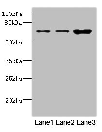 SNX18 Antibody - Western blot All Lanes: SNX18 antibody at 1.6ug/ml Lane 1: A549 whole cell lysate Lane 2: Hela whole cell lysate Lane 3: Mouse kidney tissue Secondary Goat polyclonal to rabbit IgG at 1/10000 dilution Predicted band size: 69,70,65 kDa Observed band size: 69 kDa