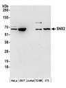 SNX2 Antibody - Detection of human and mouse SNX2 by western blot. Samples: Whole cell lysate (50 µg) from HeLa, HEK293T, Jurkat, mouse TCMK-1, and mouse NIH 3T3 cells prepared using NETN lysis buffer. Antibodies: Affinity purified rabbit anti-SNX2 antibody used for WB at 0.1 µg/ml. Detection: Chemiluminescence with an exposure time of 3 minutes.