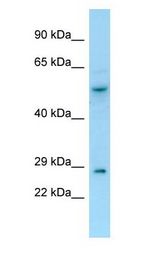 SNX2 Antibody - SNX2 antibody Western Blot of HeLa.  This image was taken for the unconjugated form of this product. Other forms have not been tested.