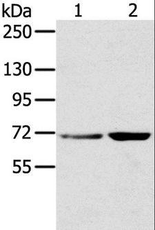 SNX2 Antibody - Western blot analysis of HeLa and 293T cell, using SNX2 Polyclonal Antibody at dilution of 1:300.