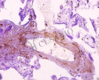 SNX20 Antibody - Immunohistochemistry of paraffin-embedded human placenta using antibody at dilution of 1:10. This image was taken for the unconjugated form of this product. Other forms have not been tested.