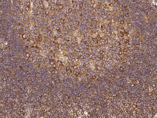 SNX21 Antibody - Immunochemical staining of human SNX21 in human lymph node with rabbit polyclonal antibody at 1:100 dilution, formalin-fixed paraffin embedded sections.