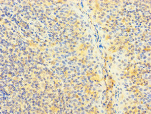 SNX22 Antibody - Immunohistochemistry of paraffin-embedded human tonsil tissue using SNX22 Antibody at dilution of 1:100
