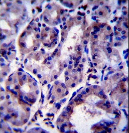 SNX24 Antibody - SNX24 Antibody immunohistochemistry of formalin-fixed and paraffin-embedded human stomach tissue followed by peroxidase-conjugated secondary antibody and DAB staining.