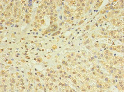 SNX24 Antibody - Immunohistochemistry of paraffin-embedded human adrenal gland tissue using SNX24 Antibody at dilution of 1:100