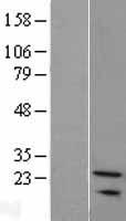 SNX24 Protein - Western validation with an anti-DDK antibody * L: Control HEK293 lysate R: Over-expression lysate