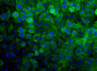 SNX27 Antibody - SNX27 Antibody - Detection of SNX27 (Green) in Hela cells. Nuclei (Blue) are counterstained using Hoechst 33258.  This image was taken for the unconjugated form of this product. Other forms have not been tested.