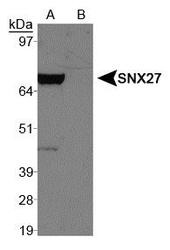 SNX27 Antibody - SNX27 Antibody - Western blot of SNX27 antibody in A. 293T + tagged SNX27 protein and B. 293T empty vector.  This image was taken for the unconjugated form of this product. Other forms have not been tested.