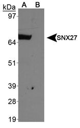 SNX27 Antibody - SNX27 Antibody - Western blot of SXN27 antibody in A. 293T + tagged SNX27 protein and B. 293T empty vector.  This image was taken for the unconjugated form of this product. Other forms have not been tested.