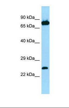 SNX27 Antibody - Western blot of Human Jurkat. SNX27 antibody dilution 1.0 ug/ml.  This image was taken for the unconjugated form of this product. Other forms have not been tested.