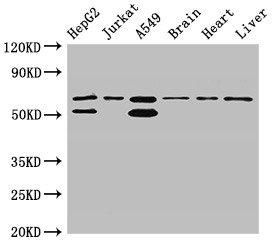 SNX27 Antibody - Positive WB detected in:HepG2 whole cell lysate,Jurkat whole cell lysate,A549 whole cell lysate,Mouse brain tissue,Rat heart tissue,Rat liver tissue;All lanes:SNX27 antibody at 3.5?g/ml;Secondary;Goat polyclonal to rabbit IgG at 1/50000 dilution;Predicted band size: 62,60,53,28 KDa;Observed band size: 62,53 KDa;