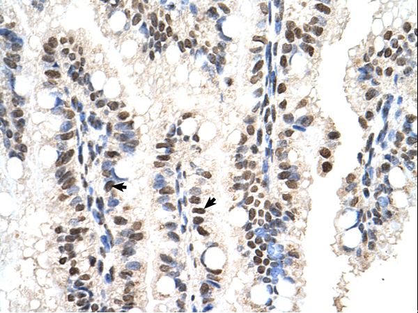 SNX29 / RUNDC2A Antibody - RUNDC2A antibody RUNDC2A(RUN domain containing 2A) Antibody was used in IHC to stain formalin-fixed, paraffin-embedded human intestine.  This image was taken for the unconjugated form of this product. Other forms have not been tested.