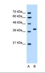 SNX29 / RUNDC2A Antibody - Lane A: Marker. Lane B: HepG2 cell lysate. Antibody concentration: 5.0 ug/ml. Gel concentration: 12%.  This image was taken for the unconjugated form of this product. Other forms have not been tested.
