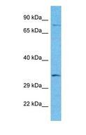 SNX29 / RUNDC2A Antibody - Western blot of SNX29 Antibody with human 721_B Whole Cell lysate.  This image was taken for the unconjugated form of this product. Other forms have not been tested.