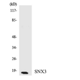 SNX3 Antibody - Western blot analysis of the lysates from HUVECcells using SNX3 antibody.