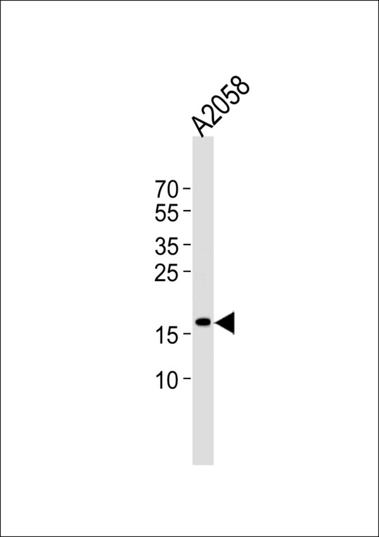 SNX3 Antibody - Western blot of lysate from A2058 cell line, using SNX3 Antibody. Antibody was diluted at 1:1000. A goat anti-rabbit IgG H&L (HRP) at 1:5000 dilution was used as the secondary antibody. Lysate at 35ug.