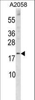 SNX3 Antibody - SNX3 Antibody western blot of A2058 cell line lysates (35 ug/lane). The SNX3 antibody detected the SNX3 protein (arrow).