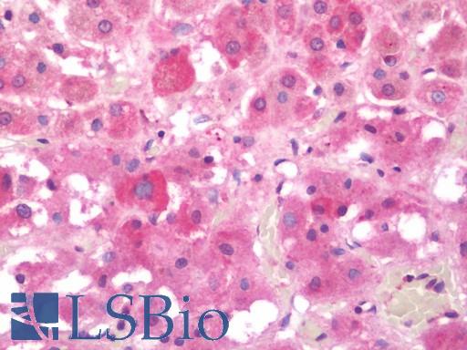 SNX3 Antibody - Anti-SNX3 antibody IHC staining of human adrenal. Immunohistochemistry of formalin-fixed, paraffin-embedded tissue after heat-induced antigen retrieval. Antibody concentration 10 ug/ml.  This image was taken for the unconjugated form of this product. Other forms have not been tested.