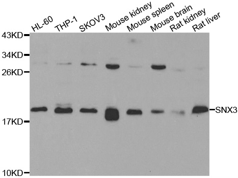 SNX3 Antibody - Western blot analysis of extracts of various cell lines.