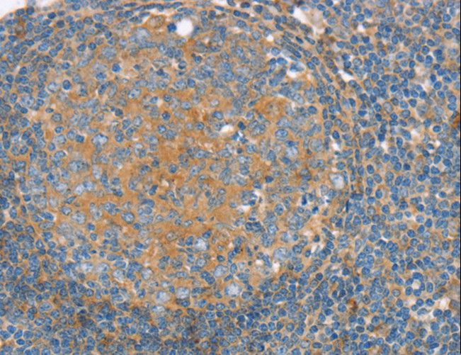 SNX3 Antibody - Immunohistochemistry of paraffin-embedded Human tonsil using SNX3 Polyclonal Antibody at dilution of 1:30.