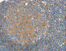 SNX3 Antibody - Immunohistochemistry of paraffin-embedded Human tonsil using SNX3 Polyclonal Antibody at dilution of 1:30.