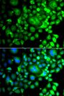 SNX3 Antibody - Immunofluorescence analysis of A549 cells using SNX3 antibody. Blue: DAPI for nuclear staining.