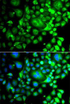 SNX3 Antibody - Immunofluorescence analysis of A549 cells using SNX3 antibody. Blue: DAPI for nuclear staining.