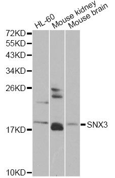 SNX3 Antibody - Western blot analysis of extracts of various cell lines, using SNX3 antibody at 1:1000 dilution. The secondary antibody used was an HRP Goat Anti-Rabbit IgG (H+L) at 1:10000 dilution. Lysates were loaded 25ug per lane and 3% nonfat dry milk in TBST was used for blocking. An ECL Kit was used for detection and the exposure time was 90s.