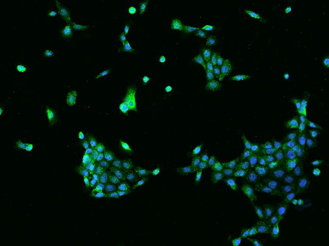 SNX3 Antibody - Immunofluorescence staining of SNX3 in A431 cells. Cells were fixed with 4% PFA, permeabilzed with 0.1% Triton X-100 in PBS, blocked with 10% serum, and incubated with rabbit anti-Human SNX3 polyclonal antibody (dilution ratio 1:100) at 4°C overnight. Then cells were stained with the Alexa Fluor 488-conjugated Goat Anti-rabbit IgG secondary antibody (green) and counterstained with DAPI (blue). Positive staining was localized to Cytoplasm.