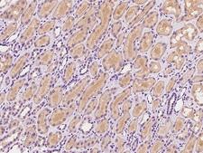 SNX3 Antibody - Immunochemical staining of human SNX3 in human kidney with rabbit polyclonal antibody at 1:100 dilution, formalin-fixed paraffin embedded sections.