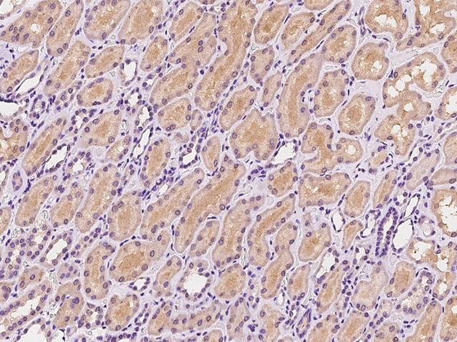 SNX3 Antibody - Immunochemical staining of human SNX3 in human kidney with rabbit polyclonal antibody at 1:100 dilution, formalin-fixed paraffin embedded sections.