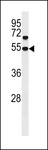 SNX30 Antibody - SNX30 Antibody western blot of human placenta tissue lysates (35 ug/lane). The SNX30 antibody detected the SNX30 protein (arrow).