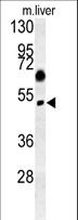SNX31 Antibody - SNX31 Antibody western blot of mouse liver tissue lysates (15 ug/lane). The SNX31 antibody detected SNX31 protein (arrow).