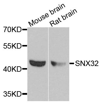 SNX32 Antibody - Western blot analysis of extracts of various cell lines.