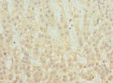 SNX32 Antibody - Immunohistochemistry of paraffin-embedded human adrenal gland tissue at dilution 1:100
