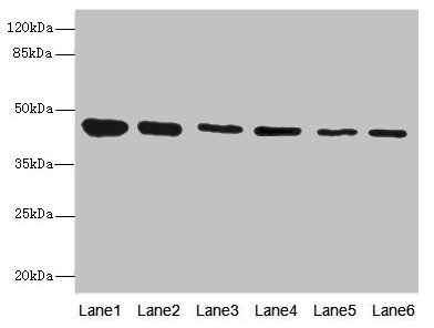 SNX32 Antibody - Western blot All Lanes: SNX32 antibody at 6.48ug/ml Lane 1: Mouse brain tissue Lane 2: Rat brain tissue Lane 3: Mouse liver tissue Lane 4: Mouse stomach tissue Lane 5: Mouse lung tissue Lane 6: Mouse kidney tissue Secondary Goat polyclonal to Rabbit IgG at 1/10000 dilution Predicted band size: 47,32 kDa Observed band size: 46 kDa