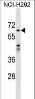 SNX33 Antibody - SNX33 Antibody western blot of NCI-H292 cell line lysates (35 ug/lane). The SNX33 antibody detected the SNX33 protein (arrow).