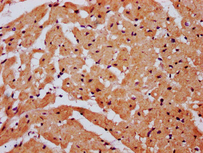 SNX33 Antibody - Immunohistochemistry Dilution at 1:800 and staining in paraffin-embedded human heart tissue performed on a Leica BondTM system. After dewaxing and hydration, antigen retrieval was mediated by high pressure in a citrate buffer (pH 6.0). Section was blocked with 10% normal Goat serum 30min at RT. Then primary antibody (1% BSA) was incubated at 4°C overnight. The primary is detected by a biotinylated Secondary antibody and visualized using an HRP conjugated SP system.