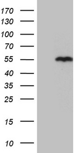 SNX4 Antibody - HEK293T cells were transfected with the pCMV6-ENTRY control. (Left lane) or pCMV6-ENTRY SNX4. (Right lane) cDNA for 48 hrs and lysed