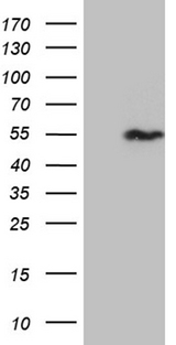 SNX4 Antibody - HEK293T cells were transfected with the pCMV6-ENTRY control. (Left lane) or pCMV6-ENTRY SNX4. (Right lane) cDNA for 48 hrs and lysed